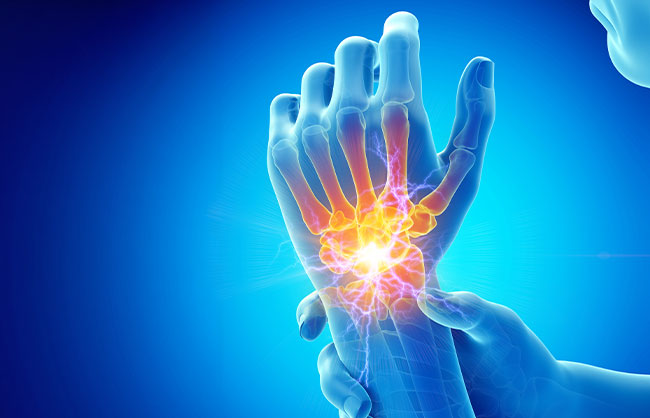 Carpal Tunnel Syndrome in Capitola, California