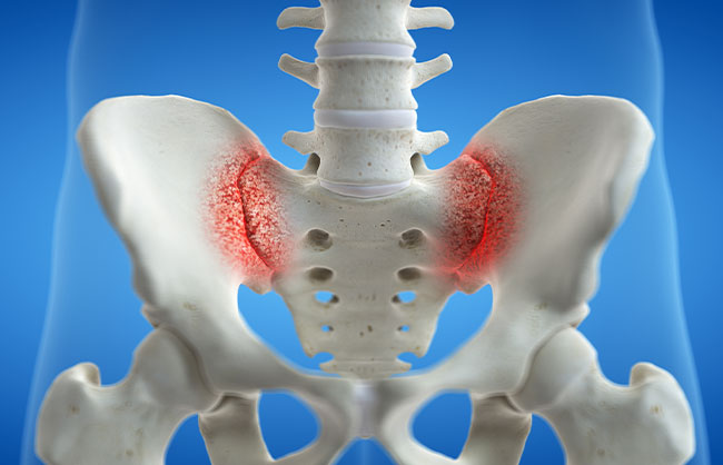 Hip Pain in Capitola, California