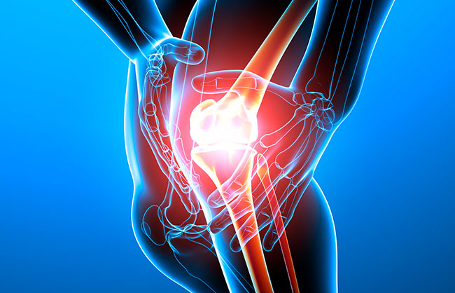 Knee Pain in Capitola, California