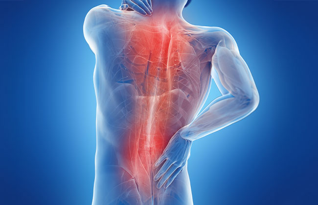 Myofascial Pain in Capitola, California