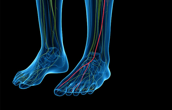 Peripheral Neuropathy in Capitola, California