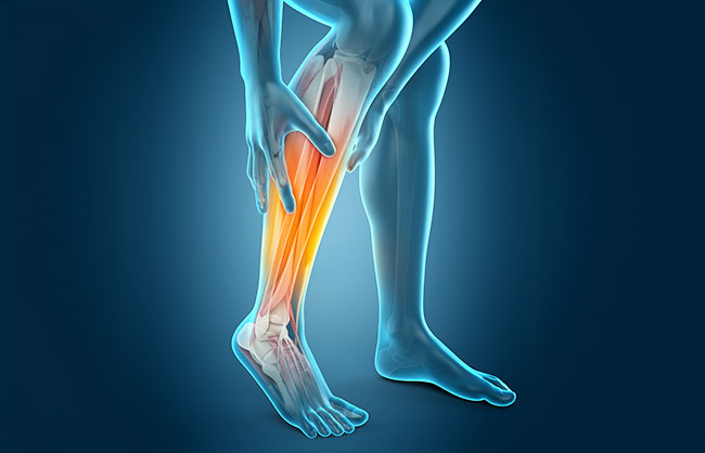 sports injury in Capitola, California