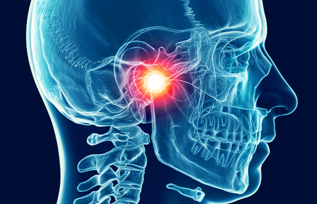 Temporomandibular Joint Disorder in Capitola, California