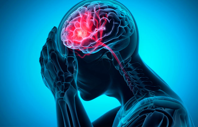 Traumatic Brain Injury in Capitola, California