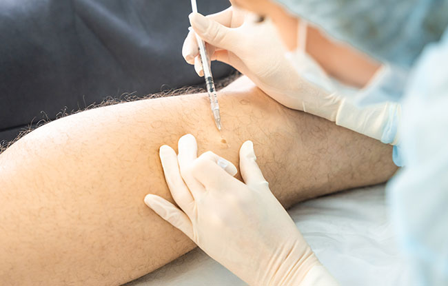 Patient undergoing Peptide Therapy at Harbor Health Center